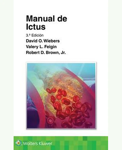 Manual de ictus