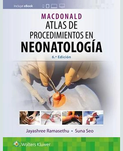 MacDonald. Atlas de procedimientos en neonatología