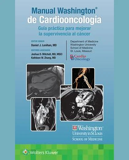 Manual Washington de Cardiooncología
