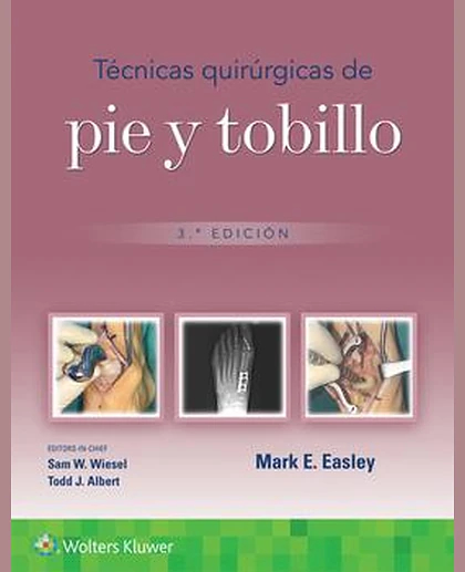 Técnicas quirúrgicas de pie y tobillo
