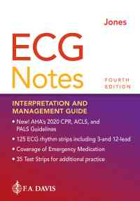 ECG Notes: Interpretation and Management Guide, 4th