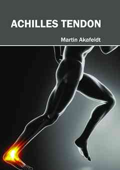 Achilles Tendon