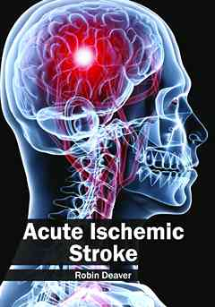 Acute Ischemic Stroke