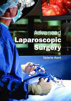 Advanced Laparoscopic Surgery