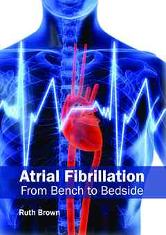 Atrial Fibrillation: from Bench to Bedside