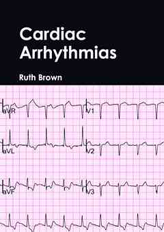 Cardiac Arrhythmias
