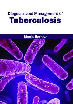 Diagnosis and Management of Tuberculosis