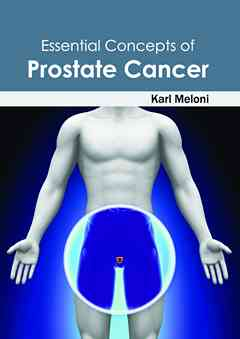 Essential Concepts of Prostate Cancer