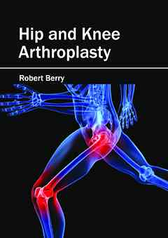 Hip and Knee Arthroplasty