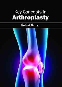 Key Concepts in Arthroplasty