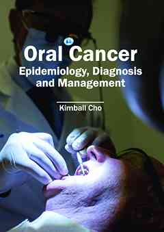 Oral Cancer: Epidemiology, Diagnosis and Management
