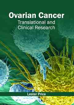 Ovarian Cancer: Translational and Clinical Research