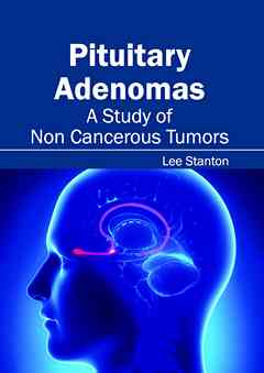 Pituitary Adenomas: a Study of Non Cancerous Tumors