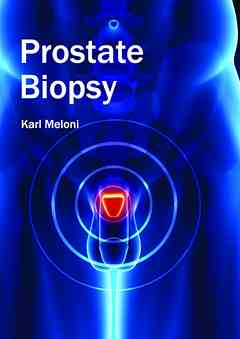 Prostate Biopsy
