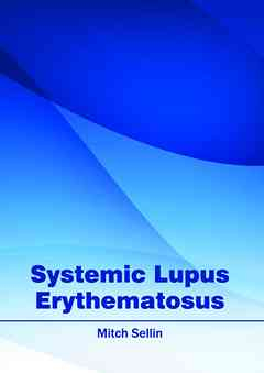 Systemic Lupus Erythematosus
