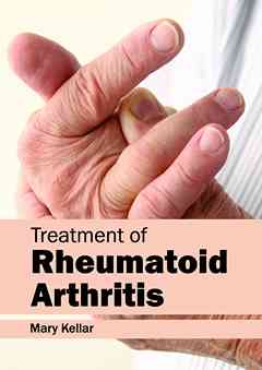 Treatment of Rheumatoid Arthritis
