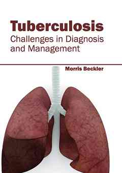 Tuberculosis: Challenges in Diagnosis and Management