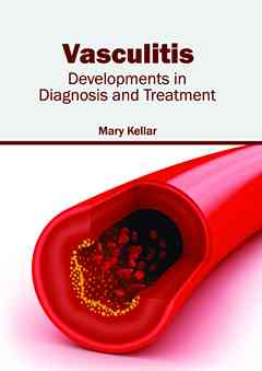 Vasculitis: Developments in Diagnosis and Treatment