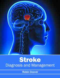Stroke: Diagnosis and Management