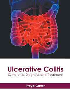 Ulcerative Colitis: Symptoms, Diagnosis and Treatment