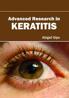 Advanced Research in Keratitis