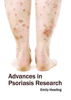 Advances in Psoriasis Research