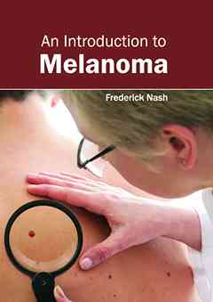 Introduction to Melanoma