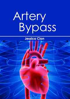 Artery Bypass