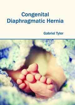 Congenital Diaphragmatic Hernia