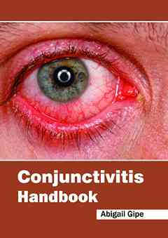 Conjunctivitis Handbook