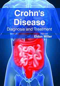 Crohn's Disease: Diagnosis and Treatment
