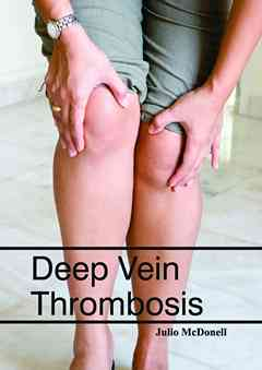 Deep Vein Thrombosis