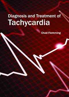 Diagnosis and Treatment of Tachycardia