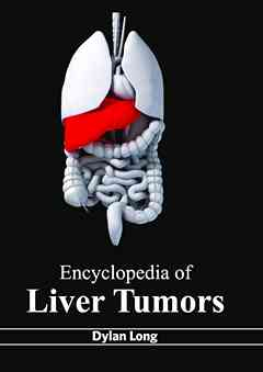 Encyclopedia of Liver Tumors