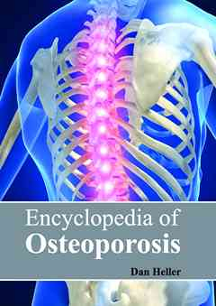 Encyclopedia of Osteoporosis