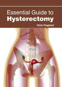 Essential Guide to Hysterectomy