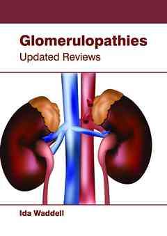 Glomerulopathies: Updated Reviews