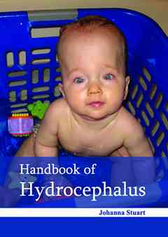 Handbook of Hydrocephalus