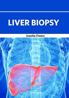 Liver Biopsy