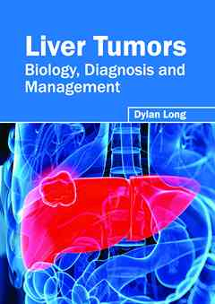 Liver Tumors: Biology, Diagnosis and Management