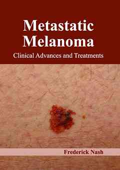 Metastatic Melanoma: Clinical Advances and Treatments