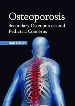 Osteoporosis: Secondary Osteoporosis and Pediatric Concerns
