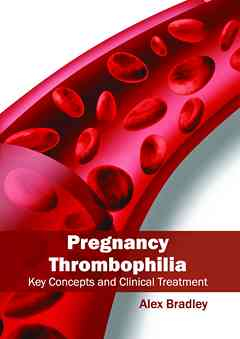 Pregnancy Thrombophilia: Key Concepts and Clinical Treatment