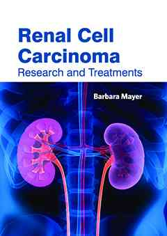 Renal Cell Carcinoma: Research and Treatments