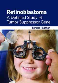 Retinoblastoma: a Detailed Study of Tumor Suppressor Gene