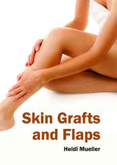 Skin Grafts and Flaps