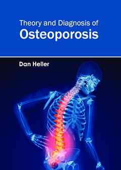 Theory and Diagnosis of Osteoporosis