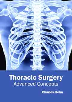 Thoracic Surgery: Advanced Concepts