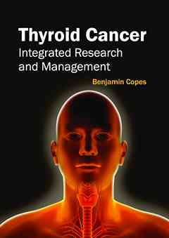 Thyroid Cancer: Integrated Research and Management