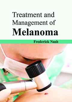 Treatment and Management of Melanoma